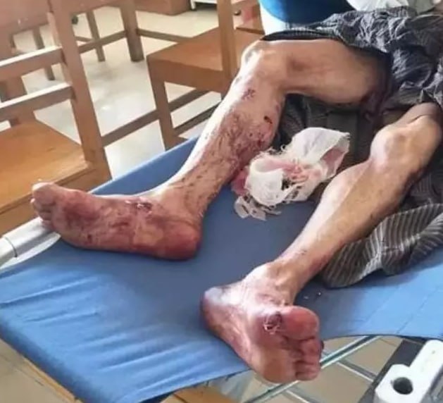 亞太警務報道｜網友爆料：戈公黑園區數十人被非法關押 逃離者懇請緊急營救